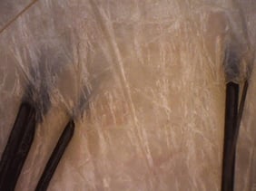 健康な頭皮 キメ