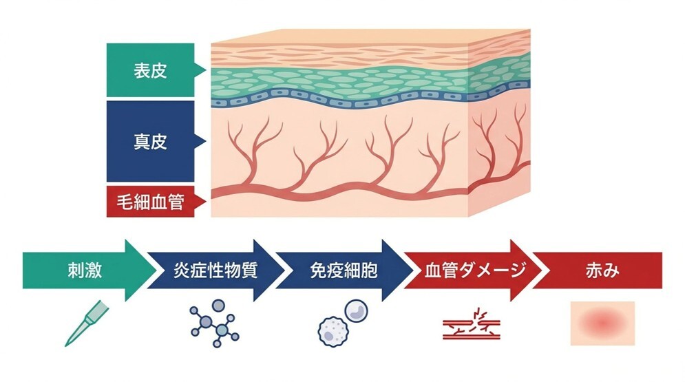 なぜ頭皮が赤くなるのか