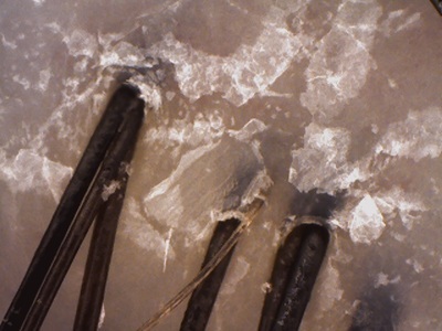 頭皮 冬 乾燥 フケ