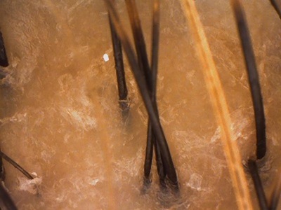 頭皮 秋 乾燥 ボリュームダウン